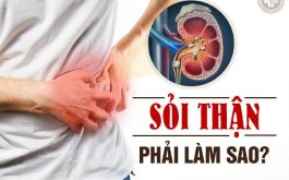 Bệnh sỏi thận