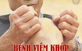 Bệnh viêm khớp