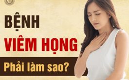 Viêm họng chớ nên chủ quan