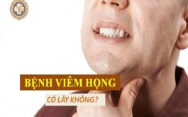 Bệnh viêm họng có lây không?