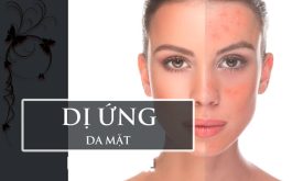 Dị ứng da mặt