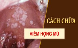 Cách chữa viêm họng mủ trắng