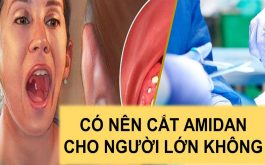 Có nên cắt amidan cho người lớn không