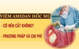 Viêm amidan hốc mủ có nên cắt không