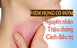 Viêm họng có đờm