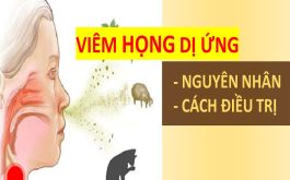 Viêm họng dị ứng