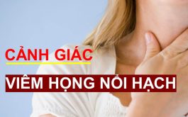 Viêm họng nổi hạch