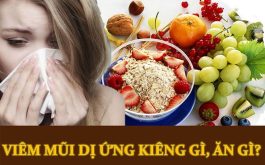 Viêm mũi dị ứng kiêng gì