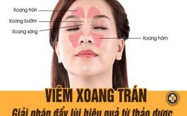 Viêm xoang trán