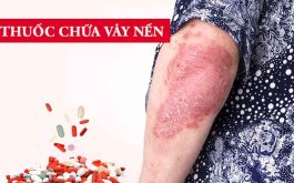 Thuốc trị vảy nến