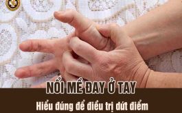 Nổi mề đay ở tay