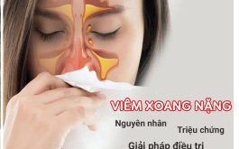 Viêm xoang nặng nguy hiểm, điều trị thế nào