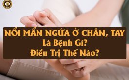 Nổi mẩn ngứa ở chân, tay là bệnh gì? Điều trị ra sao?