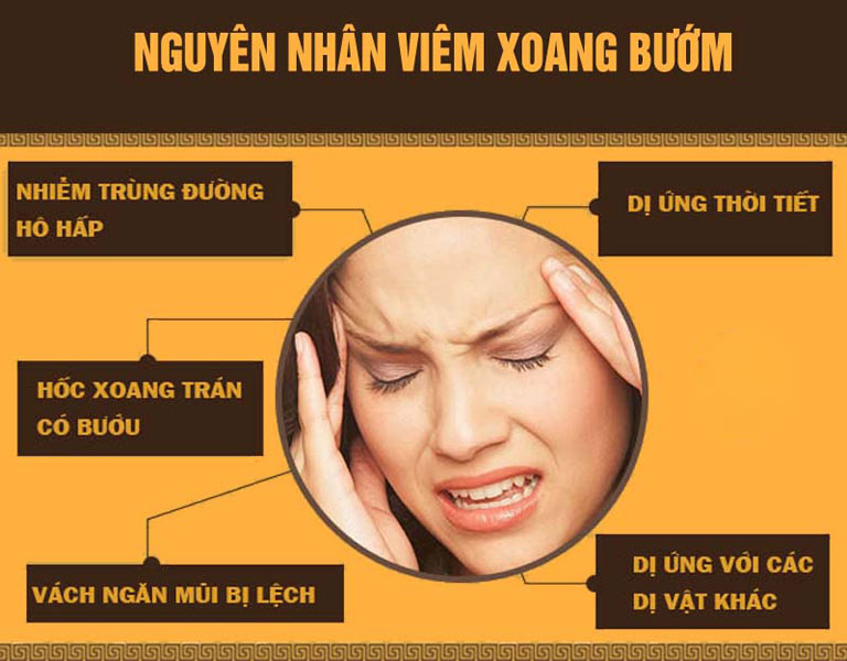 Nguyên nhân viêm xoang bướm