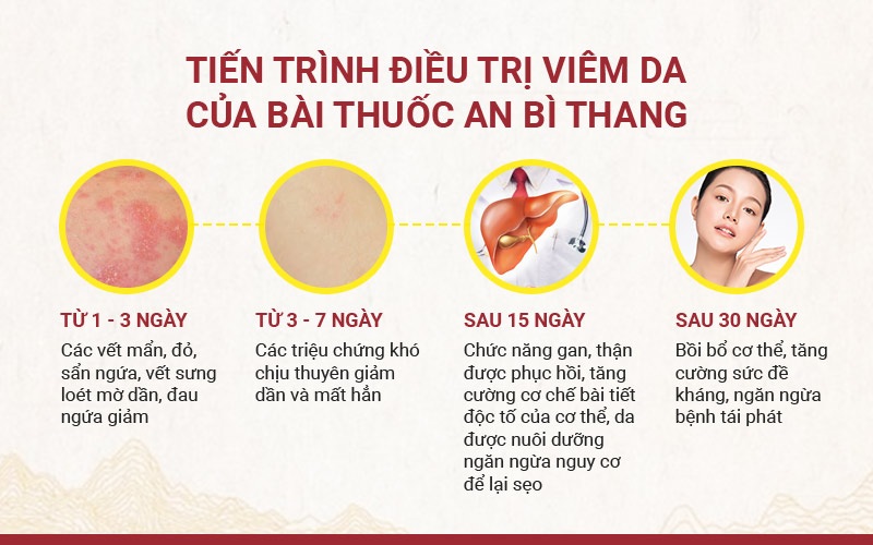 Hiệu quả khi thực hiện đúng phác đồ chữa viêm da cơ địa bằng Nhất Nam An Bì Thang