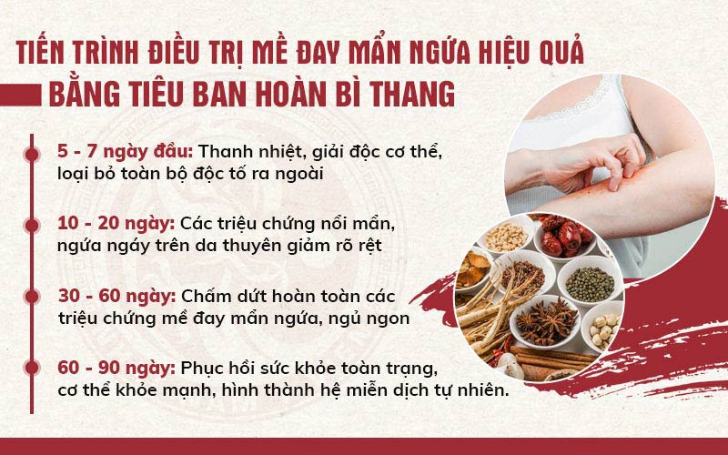 Tiến trình điều trị mề đay bằng bài thuốc Tiêu ban hoàn bì thang