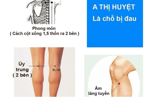 Bấm A thị huyệt chữa đau mỏi vai gáy