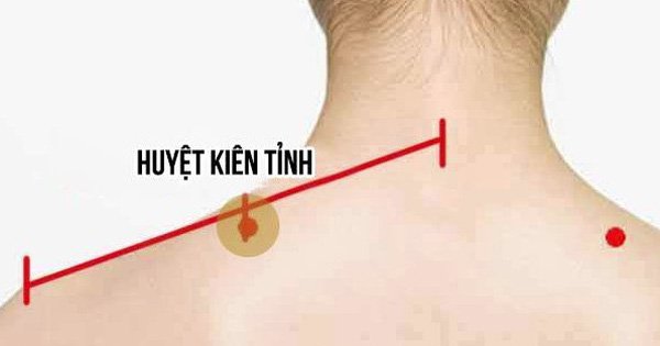 Huyệt kiên tỉnh chữa đau mỏi vai gáy