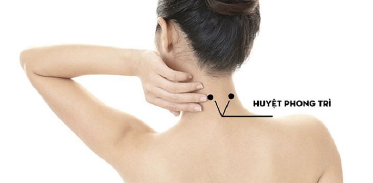 Huyệt phong trì chữa đau mỏi vai gáy