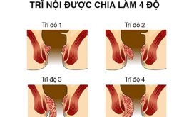 Bệnh trĩ nội - Những thông tin y khoa cần biết | Medlatec