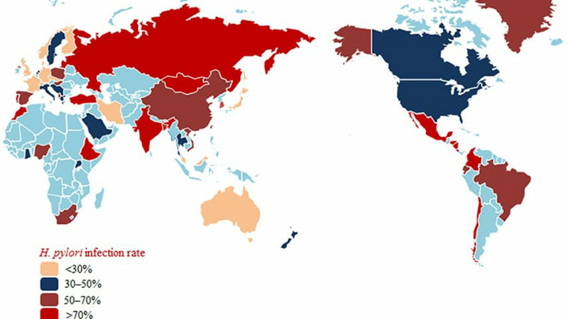 Vi khuẩn HP có lây không thắc mắc chung của rất nhiều người trên toàn cầu