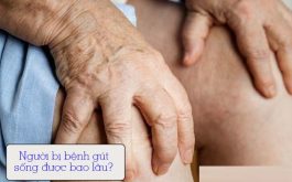 Bệnh gút sống được bao lâu là câu hỏi của nhiều người