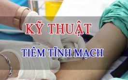 tai biến tĩnh mạch