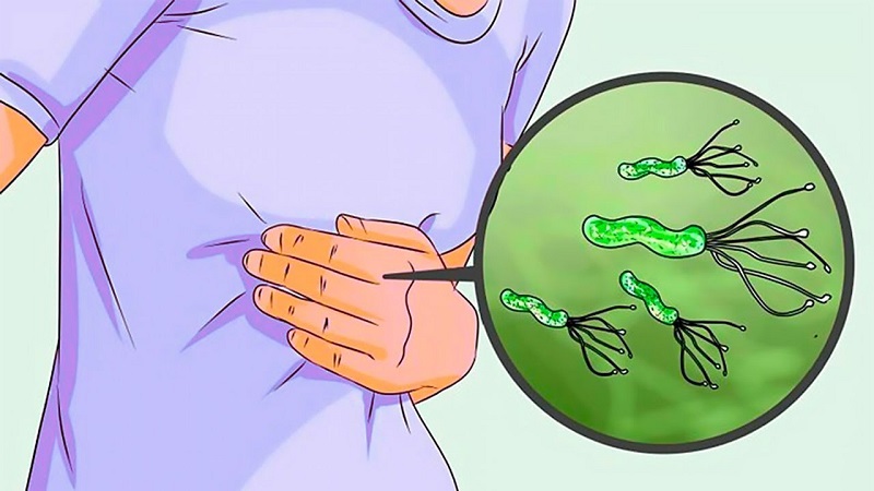 Vi khuẩn HP (Helicobacter pylori) loại một trong số loại vi khuẩn phổ biến nhất