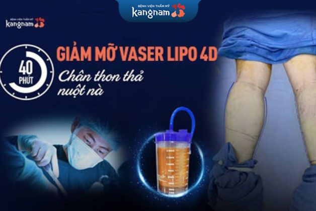 Với công nghệ cao Vaser Lipo 4D, loại bỏ triệt để 95% lượng mỡ thừa chỉ sau 40 phút (*)