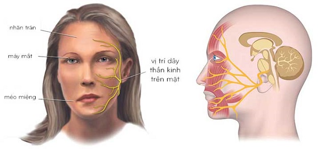 Thời gian châm cứu chữa mặt lệch phụ thuộc vào sức khỏe, cơ địa của từng người