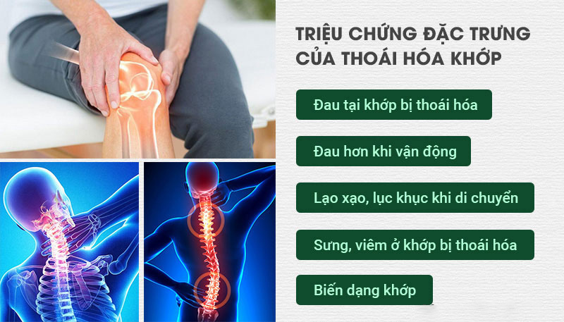 Tất cả triệu chứng thoái hóa khớp mà bạn nên biết