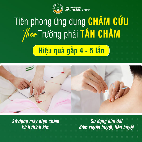 Đông Phương Y Pháp ứng dụng châm cứu theo trường phái Tân Châm cho hiệu quả gấp 4 - 5 lần thông thường