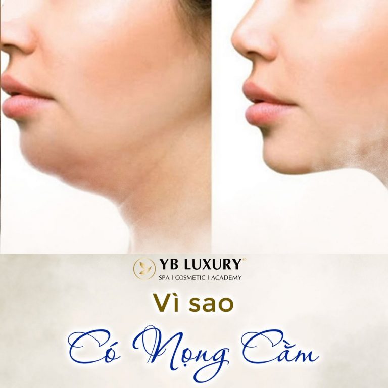 Vì sao có nọng cằm