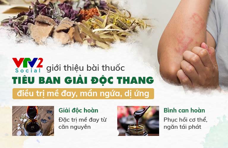 2 Nhóm thuốc chính loại bỏ căn nguyên gây mề đay