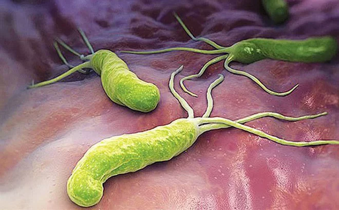 Vi khuẩn hp (helicobacter pylori) là gì? - Bệnh Viện Đa Khoa Trung Tâm An Giang