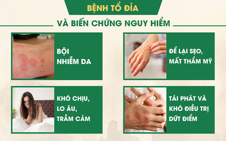 Biến chứng bệnh tổ đỉa