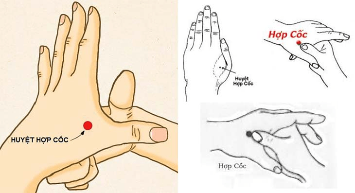 Bấm huyệt chữa đau đầu và đau nửa đầu 