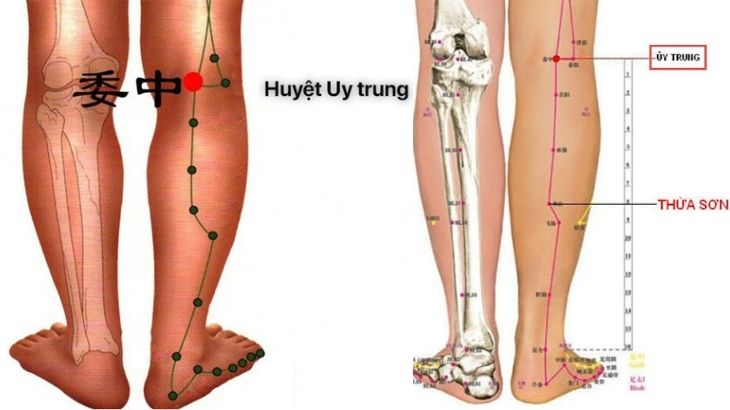 Bấm huyệt đả thông kinh mạch với huyệt ủy trung