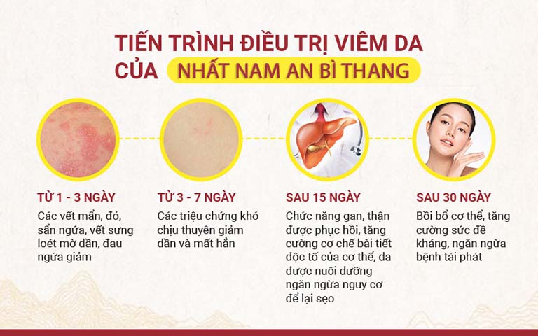 Bài thuốc Nhất Nam An Bì Thang trị viêm nang lông giá bao nhiêu? Mua ở đâu?