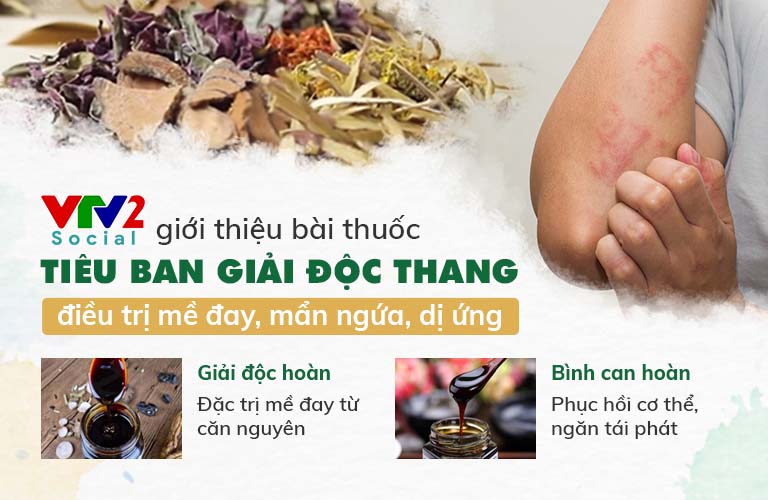 Tiêu ban Giải độc thang công thức hoàn chỉnh đặc trị mẩn ngứa từ gốc