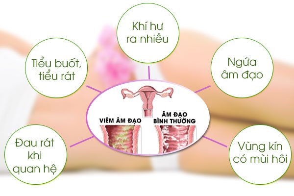 Đau lưng mỏi gối là bệnh gì? Là dấu hiệu của bệnh phụ khoa