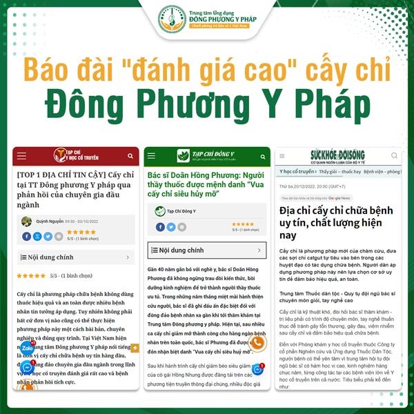 Báo đài đánh giá cao cấy chỉ Đông Phương Y Pháp